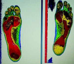 orthotics-fig03